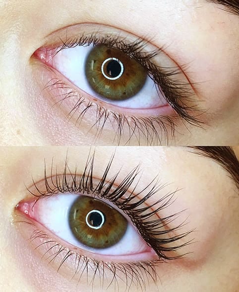 laminare-gene-lash-vitamin-bucuresti-min Laminare gene vitamin lash bucuresti